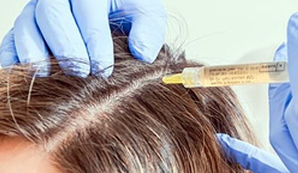 Трихология — лечение волос и кожи головы в I’m Clinik СПб
